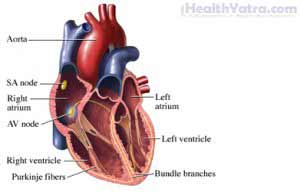 Arrhythmias Definition, Causes, Symptoms, Complications and Cost ...