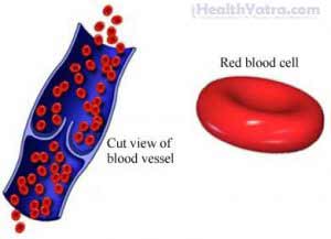 Autoimmune Hemolytic Anemia Definition, Causes, Symptoms, Complications ...