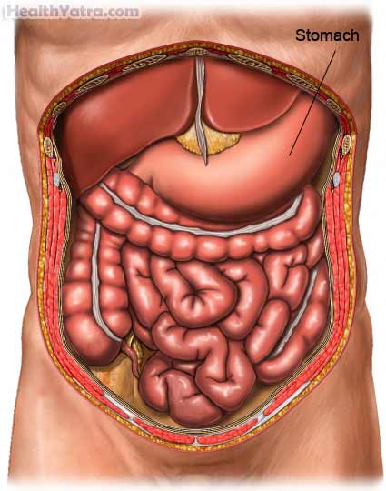 Food Poisoning Definition Causes Symptoms Complications And Cost 