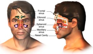 Paranasal Sinuses Cancer Treatment in India Cost Treatment Surgery Top Hospital Best Doctors in India