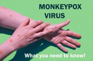 Monkeypox Symptoms, pictures, treatments & vaccines, What you need to ...