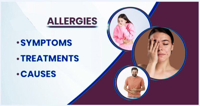 Understanding Allergies: Symptoms, Causes And Management