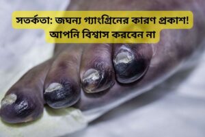 Cautionary Tales Shocking Gangrene Causes Revealed You Wont Believe bangali