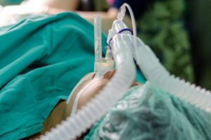 Intubation and Mechanical Ventilation Purpose Types Complications